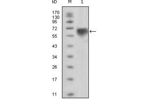 Image no. 2 for anti-TYRO3 Protein Tyrosine Kinase (TYRO3) (Extracellular) antibody (ABIN1846638)