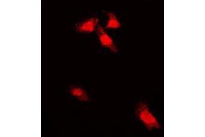 Image no. 1 for anti-GTPase Activating Protein (SH3 Domain) Binding Protein 1 (G3BP1) (pSer232) antibody (ABIN2706195)