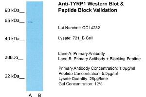 Image no. 2 for anti-Tyrosinase-Related Protein 1 (TYRP1) (Middle Region) antibody (ABIN2781815)