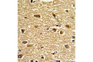 Image no. 2 for anti-Ets Variant 4 (ETV4) (AA 426-455), (C-Term) antibody (ABIN452983)