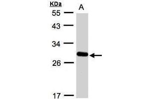 Image no. 1 for anti-Yip1 Domain Family, Member 4 (YIPF4) antibody (ABIN2154876)