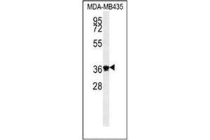 Image no. 3 for anti-Exonuclease 5 (EXO5) (AA 173-201), (Middle Region) antibody (ABIN951881)