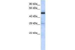 Image no. 2 for anti-Sex Comb On Midleg-Like 1 (SCML1) (Middle Region) antibody (ABIN2776468)