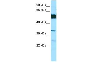 Image no. 1 for anti-Lengsin, Lens Protein with Glutamine Synthetase Domain (LGSN) (N-Term) antibody (ABIN2790296)