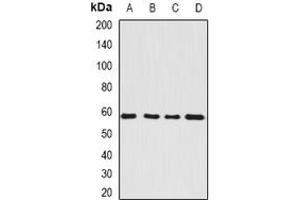 Image no. 1 for anti-Seryl-tRNA Synthetase (SARS) (full length) antibody (ABIN6005454)