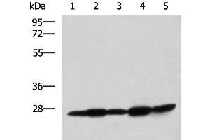Western blot analysis of Mouse liver tissue Mouse brain tissue Rat brain tissue Rat liver tissue and Human fetal liver tissue lysates using QDPR Polyclonal Antibody at dilution of 1:800