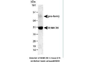 Image no. 1 for anti-Sema Domain, Immunoglobulin Domain (Ig), Short Basic Domain, Secreted, (Semaphorin) 3B (SEMA3B) (AA 100-200) antibody (ABIN363513)