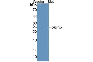 anti-ATP-Binding Cassette, Sub-Family A (ABC1), Member 8 (ABCA8) (AA 1263-1456) antibody