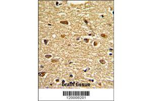 Image no. 3 for anti-Ets Variant 4 (ETV4) (AA 419-447), (C-Term) antibody (ABIN390582)