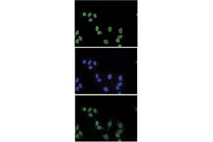 Image no. 1 for anti-Histone Cluster 1, H3a (HIST1H3A) (3meLys27) antibody (ABIN5773864)