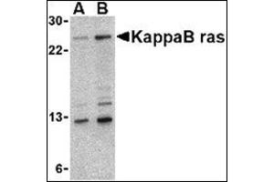 Image no. 2 for anti-NFKB Inhibitor Interacting Ras-Like 1 (NKIRAS1) (Center) antibody (ABIN500110)