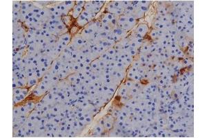 Image no. 1 for anti-Signal Transducer and Activator of Transcription 1, 91kDa (STAT1) (pTyr701) antibody (ABIN6255991)
