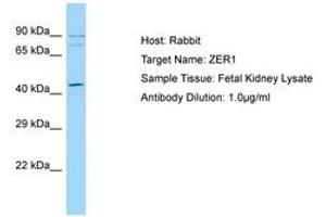 Image no. 1 for anti-Zyg-11 Related, Cell Cycle Regulator (ZER1) (C-Term) antibody (ABIN6749948)