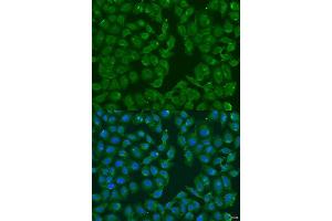 Image no. 2 for anti-Methionine Sulfoxide Reductase B3 (MSRB3) antibody (ABIN6144093)