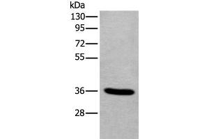 Western blot analysis of Human fetal liver tissue lysate using TNMD Polyclonal Antibody at dilution of 1:400