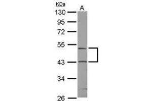 anti-RUN Domain Containing 3A (RUNDC3A) (AA 4-236) antibody