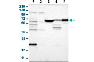 Image no. 1 for anti-Junctophilin 1 (JPH1) antibody (ABIN5581377)