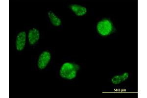 Image no. 2 for anti-Iroquois Homeobox Protein 2 (IRX2) (AA 1-471) antibody (ABIN531056)