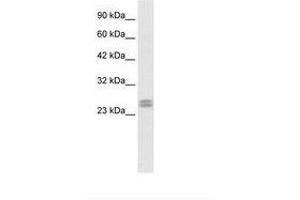 Image no. 1 for anti-Hairy and Enhancer of Split 7 (HES7) (AA 63-112) antibody (ABIN6735843)