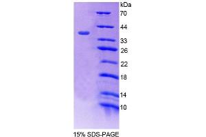Image no. 1 for Atrophin 1 (ATN1) (AA 879-1190) protein (His tag) (ABIN6239059)