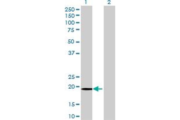 FUNDC2 Antikörper  (AA 1-189)