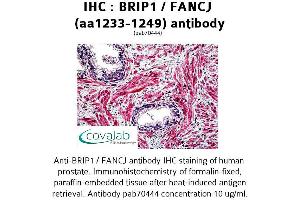 Image no. 2 for anti-BRCA1 Interacting Protein C-terminal Helicase 1 (BRIP1) (AA 1233-1249) antibody (ABIN1732408)