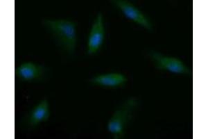 Image no. 8 for anti-Musashi Homolog 2 (MSI2) antibody (ABIN1499578)
