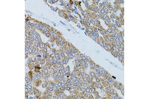 Image no. 2 for anti-Guanine Nucleotide Binding Protein (G Protein), alpha 13 (GNA13) antibody (ABIN6141194)