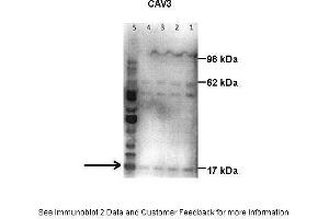 Image no. 3 for anti-Caveolin 3 (CAV3) (N-Term) antibody (ABIN2792221)