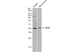 Image no. 1 for anti-Deleted in Azoospermia-Like (DAZL) (C-Term) antibody (ABIN2854662)