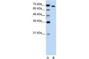 anti-RAR-Related Orphan Receptor A (RORA) (Middle Region) antibody