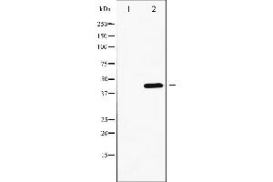 Image no. 10 for anti-GATA Binding Protein 4 (GATA4) (pSer262) antibody (ABIN6256227)