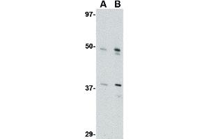 Image no. 1 for anti-Fasciculation and Elongation Protein zeta 2 (Zygin II) (FEZ2) (Internal Region) antibody (ABIN6657049)