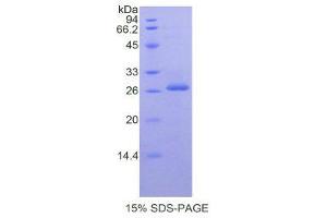 Image no. 1 for Prostate Specific Antigen (PSA) (AA 39-261) protein (His tag) (ABIN1877792)
