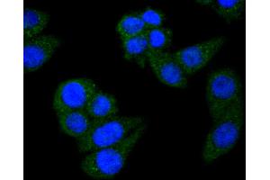 Image no. 2 for anti-Signal Transducer and Activator of Transcription 6, Interleukin-4 Induced (STAT6) antibody (ABIN5557533)