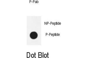 Image no. 1 for anti-Nuclear Factor kappa B (NFkB) (pSer536) antibody (ABIN3001943)