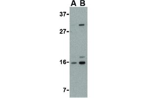 Image no. 3 for anti-DNA-Damage Regulated Autophagy Modulator 1 (DRAM1) (C-Term) antibody (ABIN6656858)