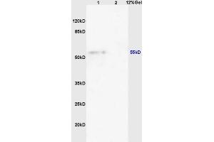 Image no. 2 for anti-CASP8 and FADD-Like Apoptosis Regulator (CFLAR) (AA 7-100) antibody (ABIN725255)