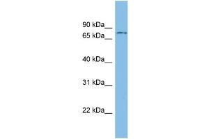 Image no. 3 for anti-Adrenergic, Beta, Receptor Kinase 1 (ADRBK1) (N-Term) antibody (ABIN2784714)