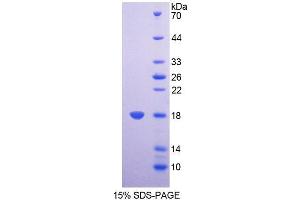 Image no. 1 for Succinate Dehydrogenase Complex, Subunit D, Integral Membrane Protein (SDHD) (AA 1-159) protein (T7 tag,His tag) (ABIN6237617)