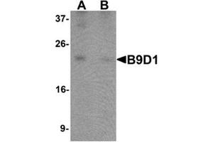 Image no. 2 for anti-B9 Protein Domain 1 (B9D1) (C-Term) antibody (ABIN1450121)