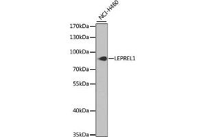 LEPREL1 antibody  (AA 400-700)