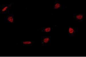 Image no. 1 for anti-Nuclear Transcription Factor Y, alpha (NFYA) (C-Term) antibody (ABIN2682412)