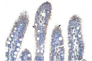 Image no. 2 for anti-Ornithine Carbamoyltransferase (OTC) (N-Term) antibody (ABIN629690)