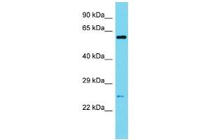 Image no. 1 for anti-Sperm Associated Antigen 7 (SPAG7) (N-Term) antibody (ABIN2790586)