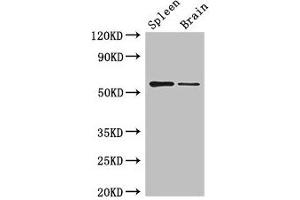 D2HGDH anticorps  (AA 14-521)