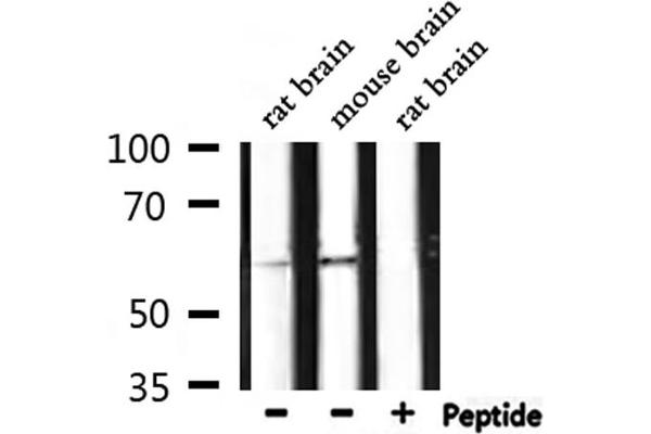 HDAC3 antibody  (pSer424)