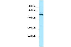 Image no. 3 for anti-Sperm Adhesion Molecule 1 (PH-20 Hyaluronidase, Zona Pellucida Binding) (SPAM1) (C-Term) antibody (ABIN2789782)