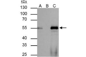IP Image FOXA1 antibody immunoprecipitates FOXA1 protein in IP experiments.