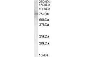 Image no. 2 for anti-Proprotein Convertase Subtilisin/kexin Type 9 (PCSK9) (C-Term) antibody (ABIN185371)